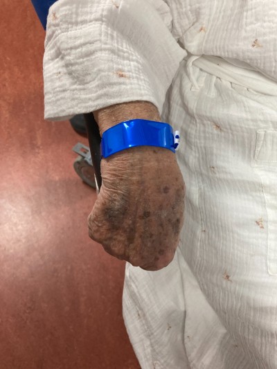 blue wristband on person's wrist
