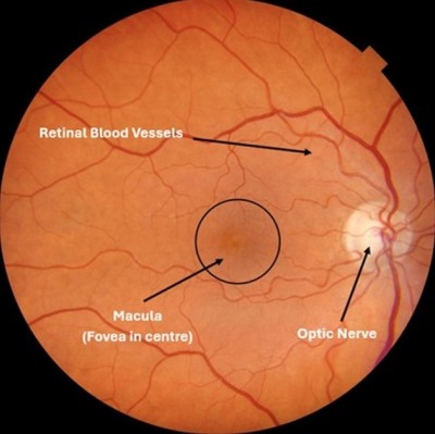 image of a healthy retina