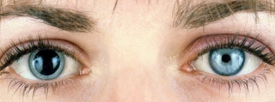 eye diagram diabetic eye screening.png